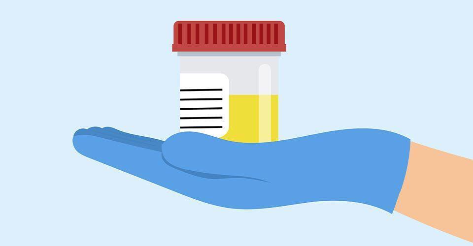 OTM urine istock